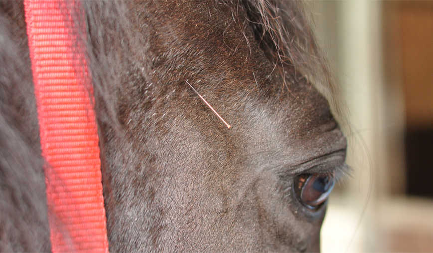 Akupunkturnadel auf dem Magen-Meridian 